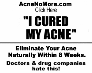 acne no more reviews